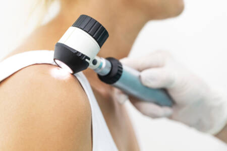 The alarming predictions for melanoma rates