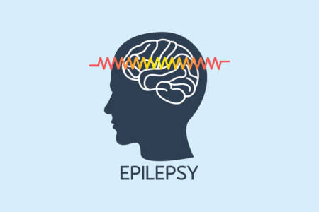 Understanding Epilepsy