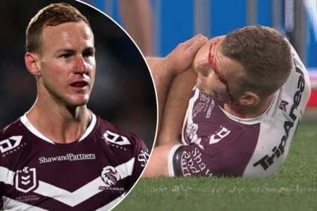 ‘Bloody tough’: Why DCE is backing Turbo to return from latest injury